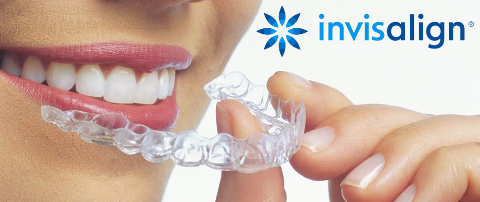 invisalign locust nc dentist