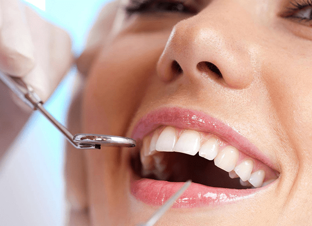 dental cleaning locust nc