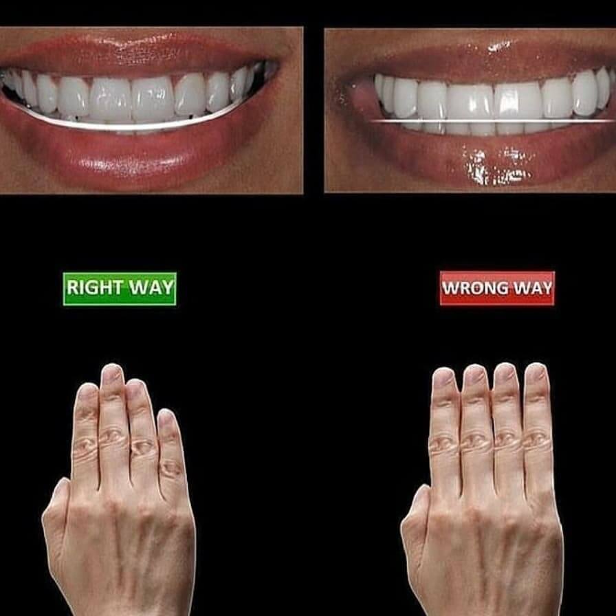 Invisalign in Locust, NC before and after