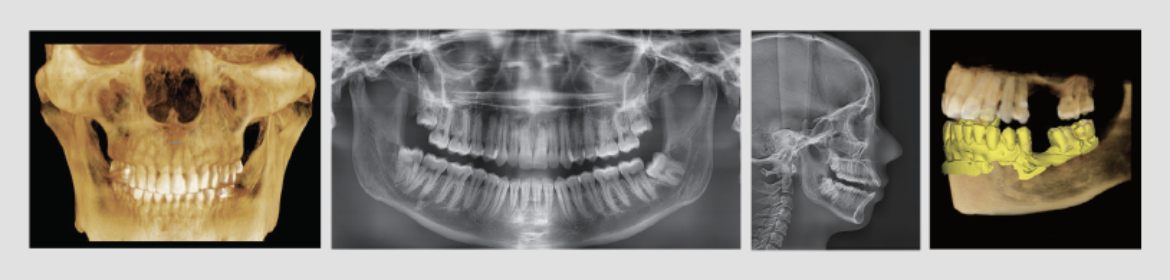dental x-rays in Locust, NC